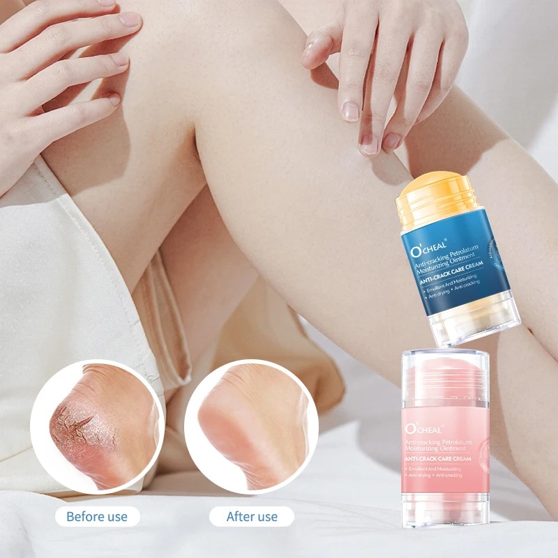 Krim Kaki Anti Retak Untuk Kak - Heels ulasan dan harga